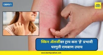 Skin Allergies : मुरूम, खाज आणि लाल चट्टे ! स्किन अॅलर्जीवर ट्राय करा 'हे' प्रभावी घरगुती रामबाण उपाय