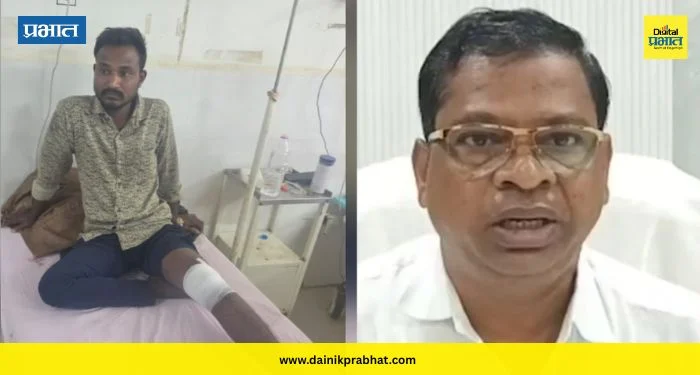 Crime News : काँग्रेस आमदाराकडून मजुराला बेदम मारहाण; रुग्णालयात उपचार सुरु