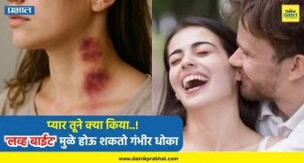 Love Bite Side Effects : प्यार तूने क्या किया..! 'लव्ह बाईट' मुळे होऊ शकतो गंभीर धोका, आत्ताच सावध व्हा !