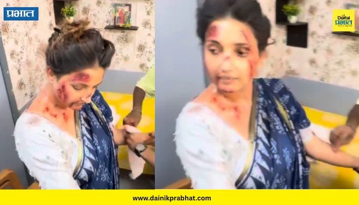 Rupali Bhosale : चेहऱ्यावर, हातावर जखमा…; रुपाली भोसलेचा लुक पाहून चाहतेही झाले थक्क