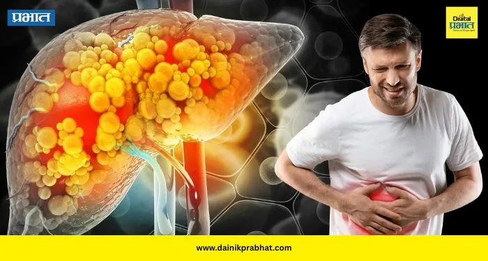 Fatty Liver: यकृताची काळजी का महत्त्वाची? डॉक्टर सांगतात फॅटी लिव्हर टाळण्याचे सोपे मार्ग