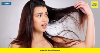 Monsoon Care: पावसाळ्यात केस का गळतात? 'ही' कारणं जाणून घ्या आणि वेळेत उपाय करा