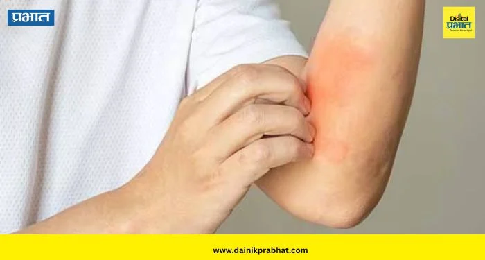 Liver Health: त्वचेवर दिसतायत ‘ही’ लक्षणं? दुर्लक्ष करू नका; लिव्हरच्या आजाराचा असू शकतो इशारा
