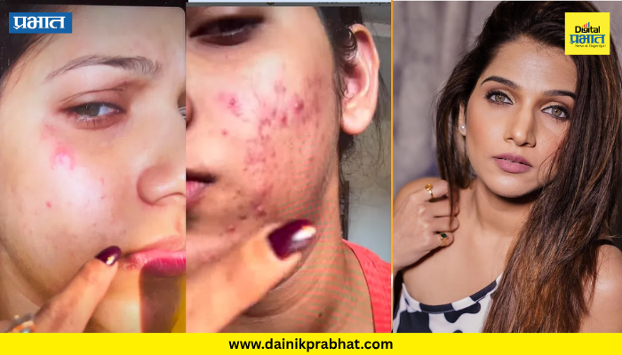 Janhavi Killekar: ‘बिस्लेरीने अंघोळ का?’ ट्रोलिंगनंतर जान्हवी किल्लेकरचा संताप; दाखवले चेहऱ्याचे जुने फोटो