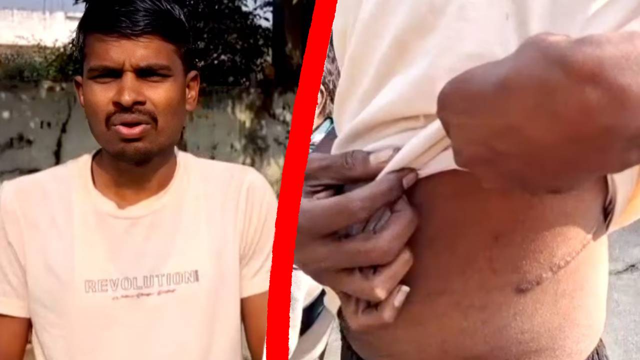 कर्ज के दलदल में फंसा किसान: एक लाख का कर्ज बना 74 लाख, जान बचाने को बेचनी पड़ी किडनी